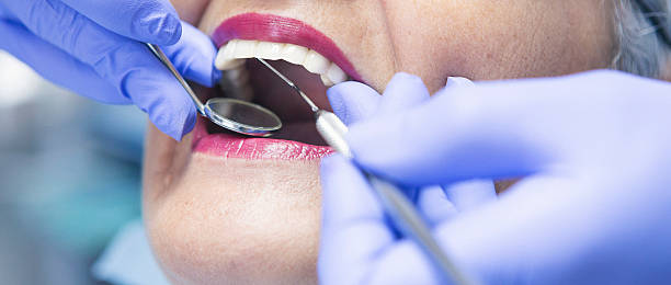 Best Emergency Root Canal Treatment in Belle Isle, FL